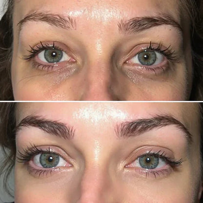 DermaFuse Patches