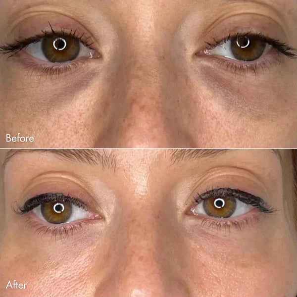 DermaFuse Patches