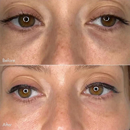DermaFuse Patches